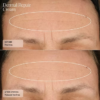 Dermal Repair Cream