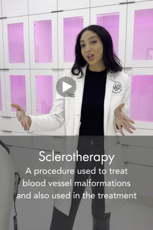 Sclerotherapy