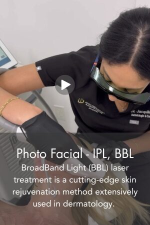 Photo Facial IPL, BBL
