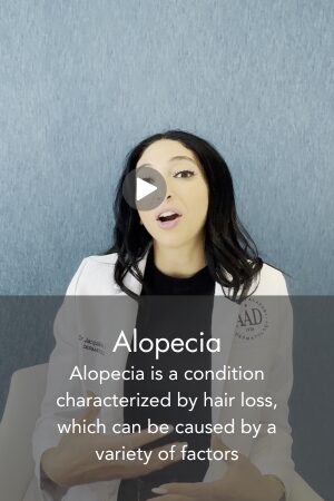 Alopecia