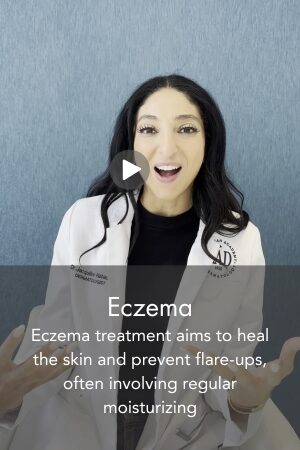 Eczema