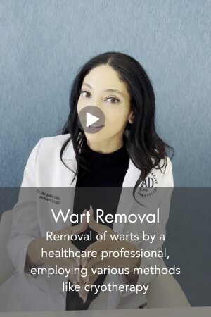 Wart Removal
