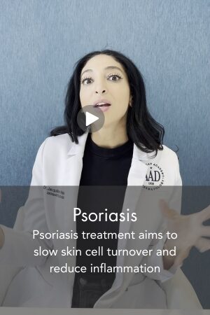 Psoriasis