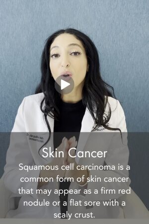 Skin Cancer
