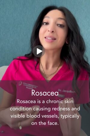 Rosacea