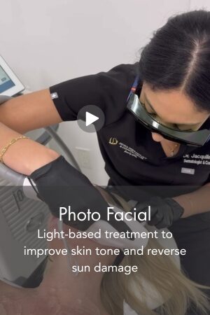 Photo Facial