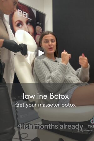 Jawline Botox