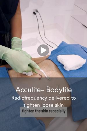 Accutite-Bodytite