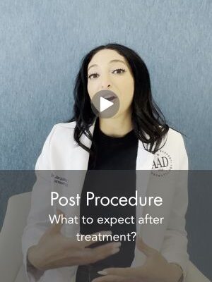 Post Procedure